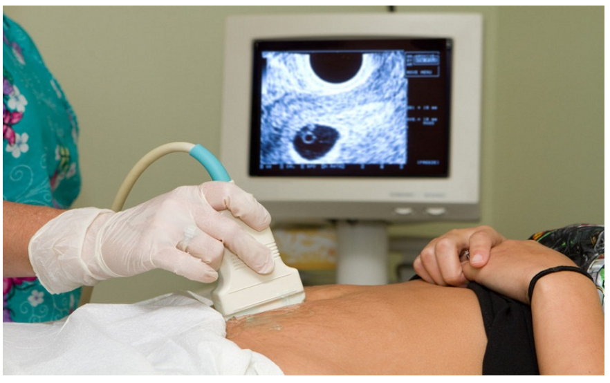 Ultra Sonography